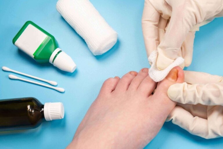 Find Expert Toenail Fungus Care Near You today