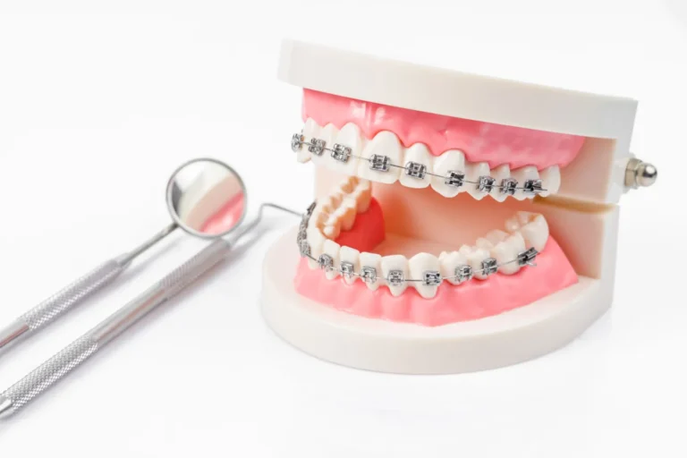 What to Expect: Invisalign Cost Guide and Timeline