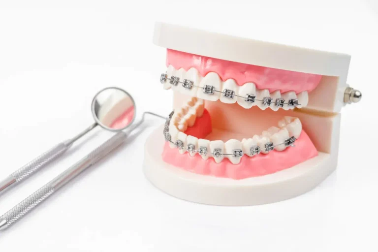 Confident, discreet orthodontic care for a perfect smile Confident, discreet orthodontic care for a perfect smile